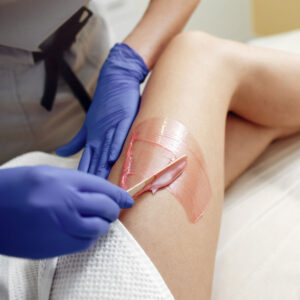 decoloracion con vellos