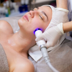 radiofrecuencia facial